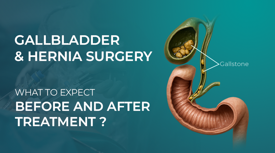 Gallbladder Problems Treatment in Guntur